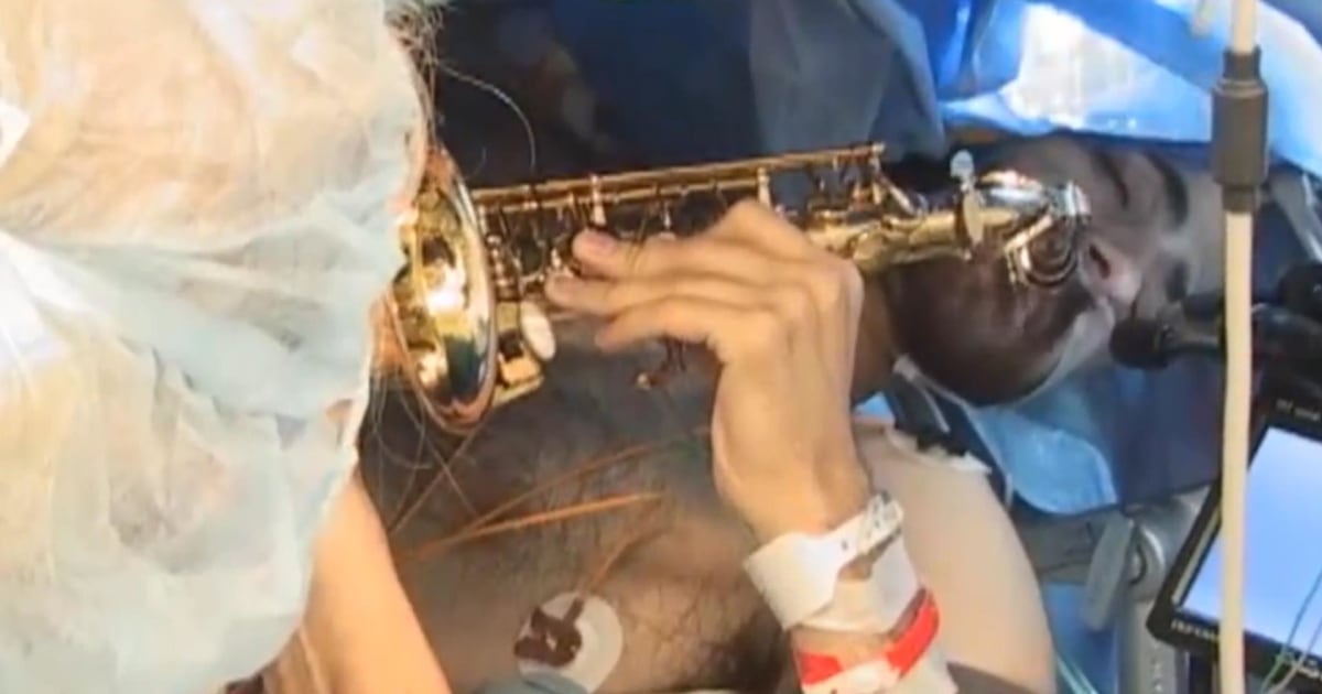 Musician Dan Fabbio Plays Saxophone While Doctors Remove Brain Tumor 