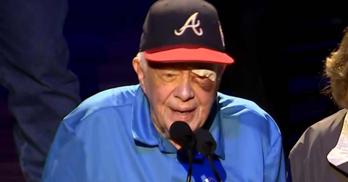 Jimmy Carter, with black eye and stitches, makes public appearance