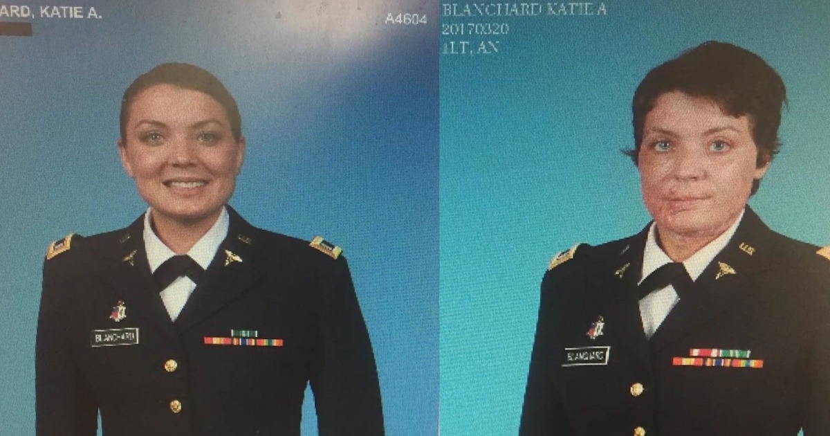 Army nurse lit on fire now faces a new battle: Suing the U.S. Army for negligence - NBC News