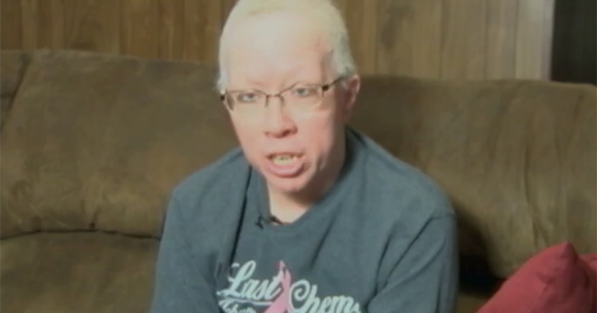 Cancer Survivor Says She Was Humiliated by Store Employees