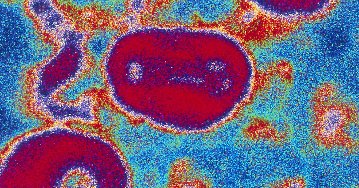 Smallpox Vials Discovered in NIH Storage Room