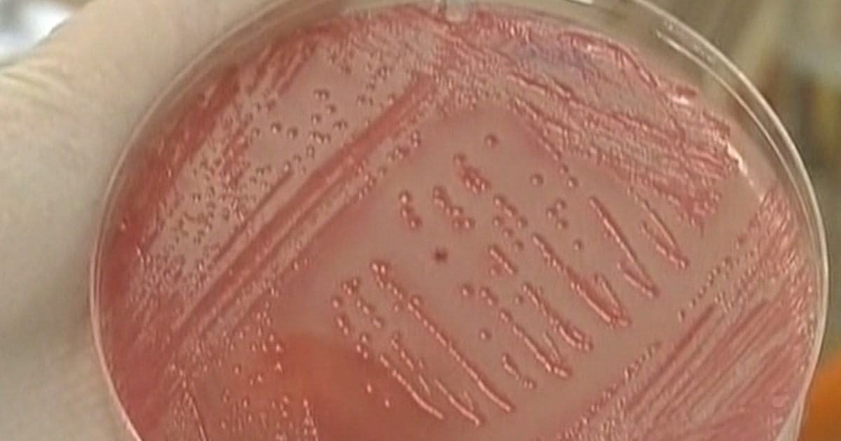 E. coli outbreak grows; source unknown