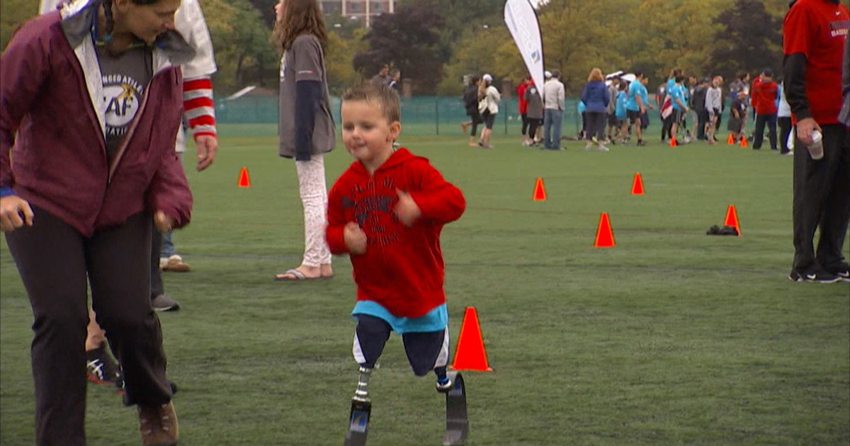 Boston marathon amputees make strides toward recovery