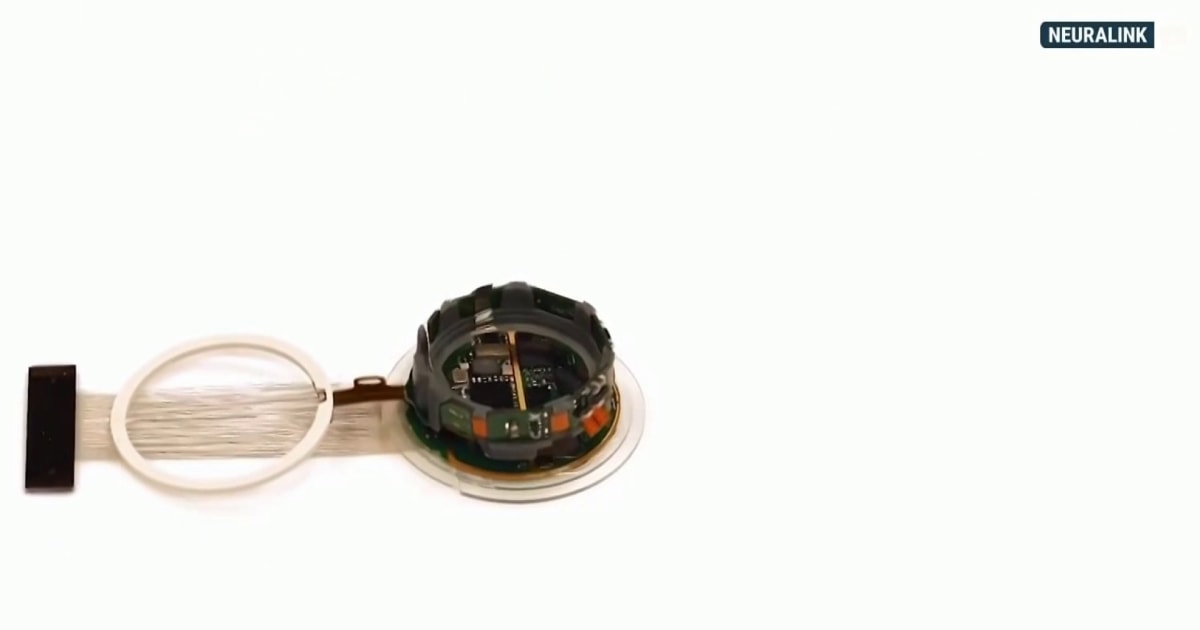 FDA allows Neuralink to implant second patient with brain chip