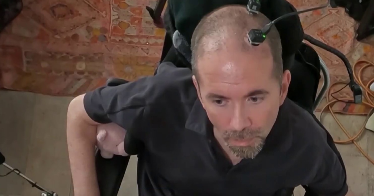 New technology allows man with ALS to communicate using brain implant and AI voice