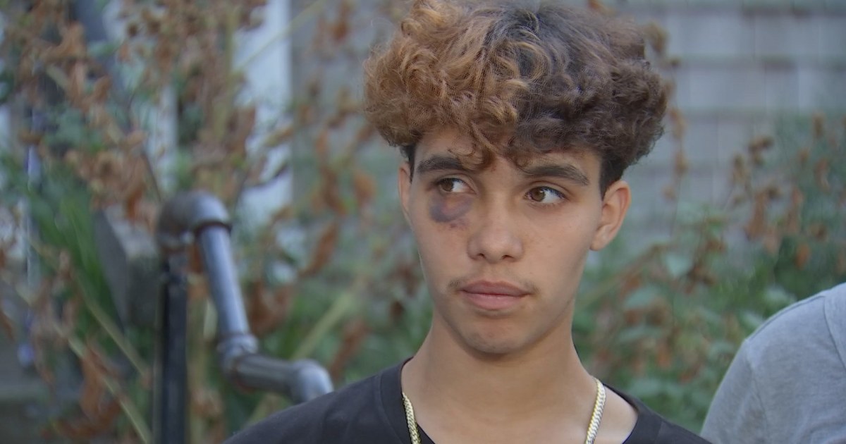 Transgender Teen Attacked at Gloucester Party