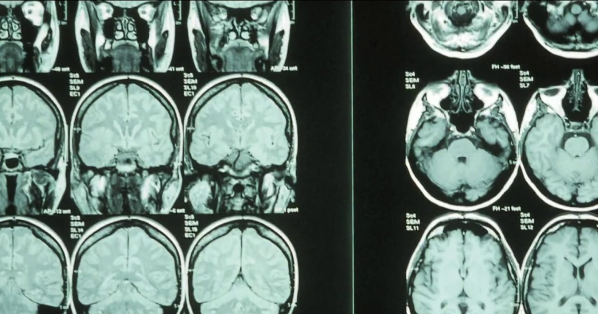 Study shows how thumbs helped shape the brain