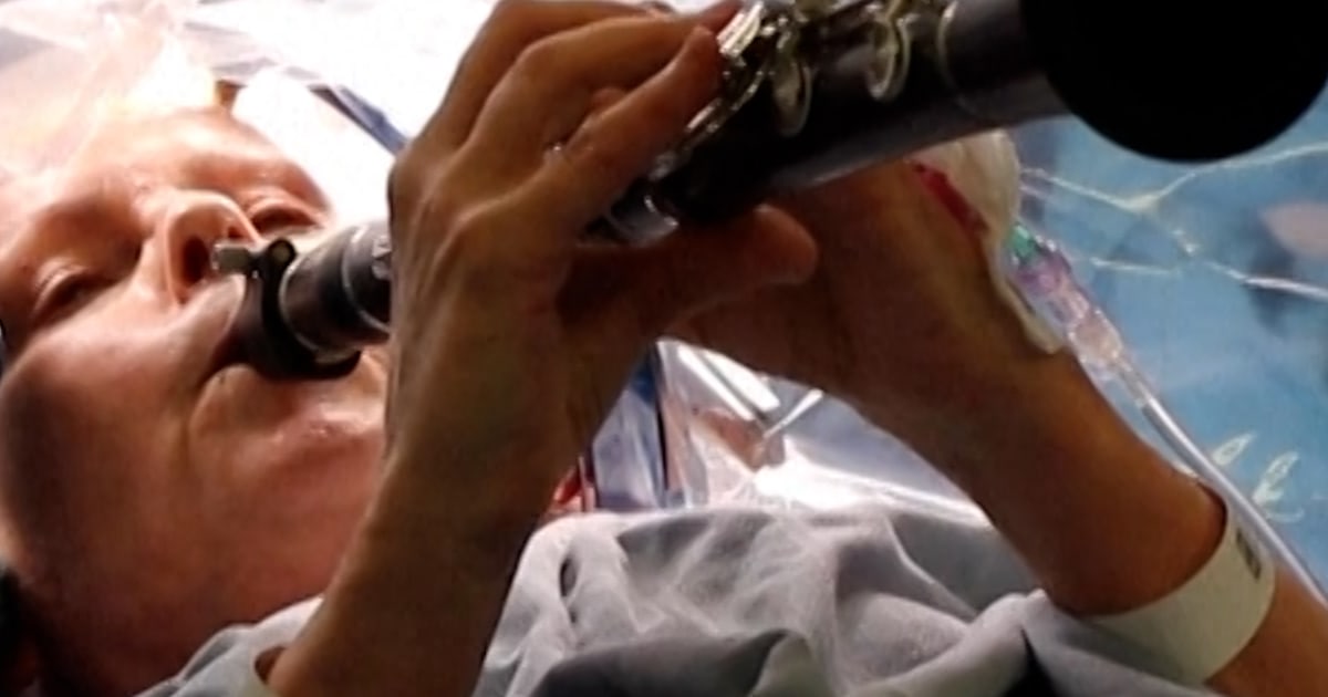 Parkinson’s affected person performs clarinet throughout mind surgical procedure