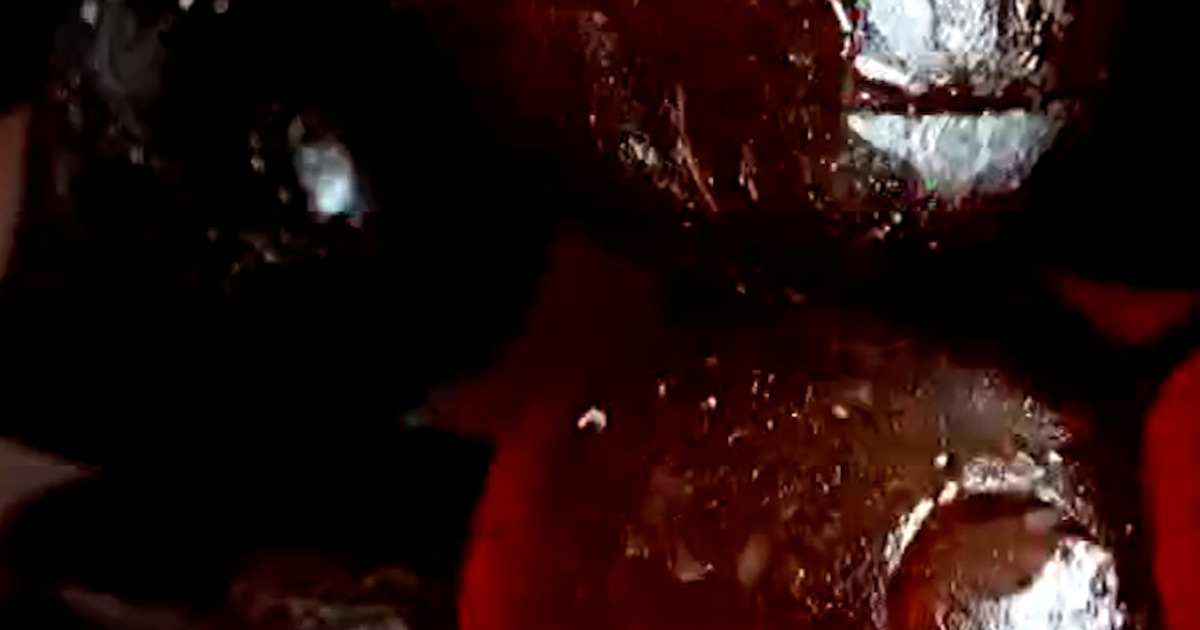 Study suggests link between melatonin use and heart disease