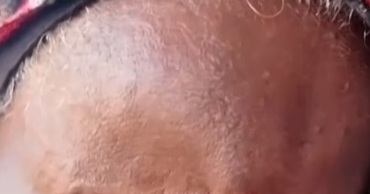 Sudanese Women's Bodies Turned Into 'crime Scenes'