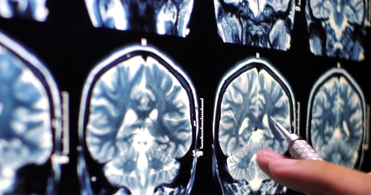 How time in space impacts astronauts' brain