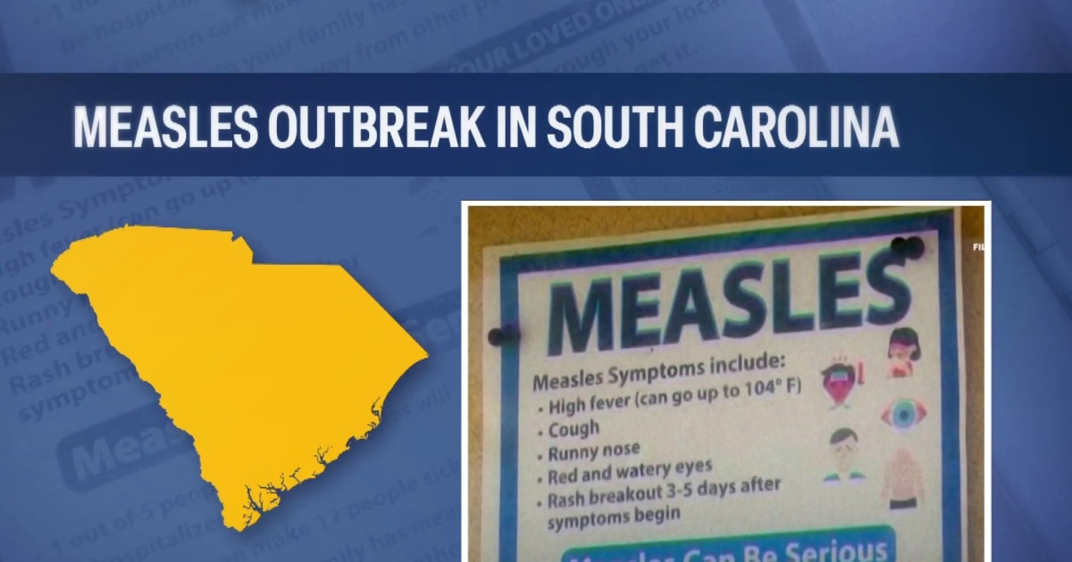 Massive measles outbreak in South Carolina surges