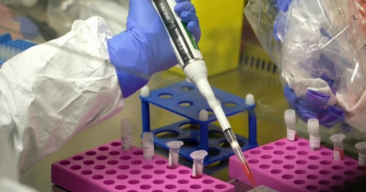 U.S. health officials monitor deadly virus