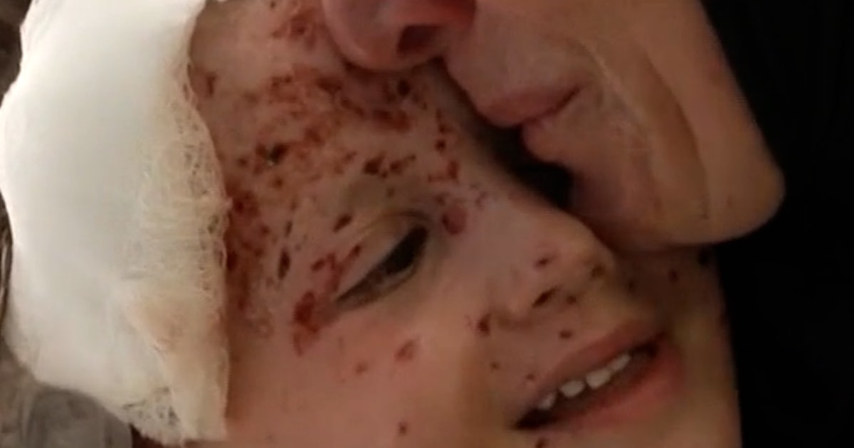 Inside a Beirut hospital treating wounded children