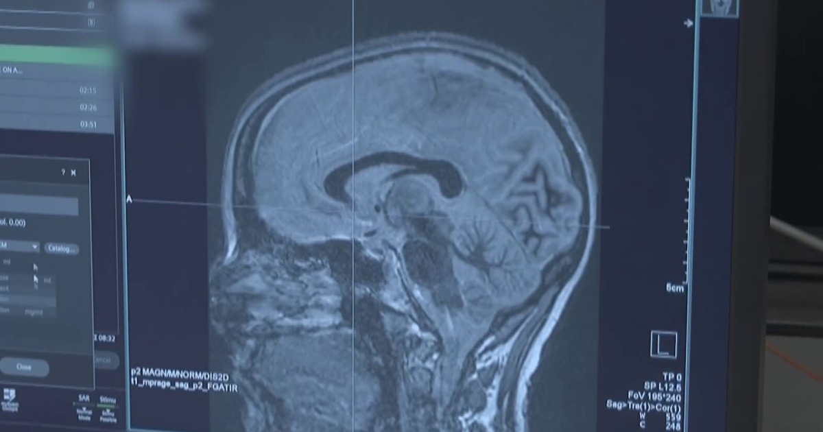 New technology offers hope for Parkinson’s patients