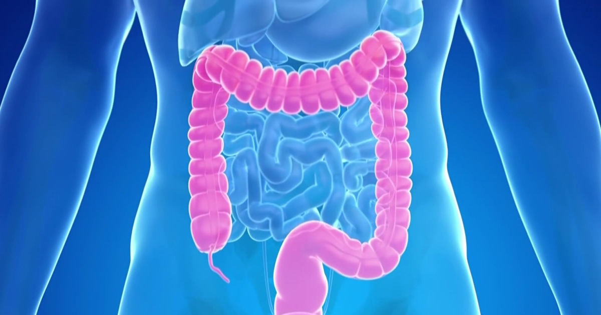 New Blood Test Is Added An An Option For Colorectal Cancer Screenings - Beritaja