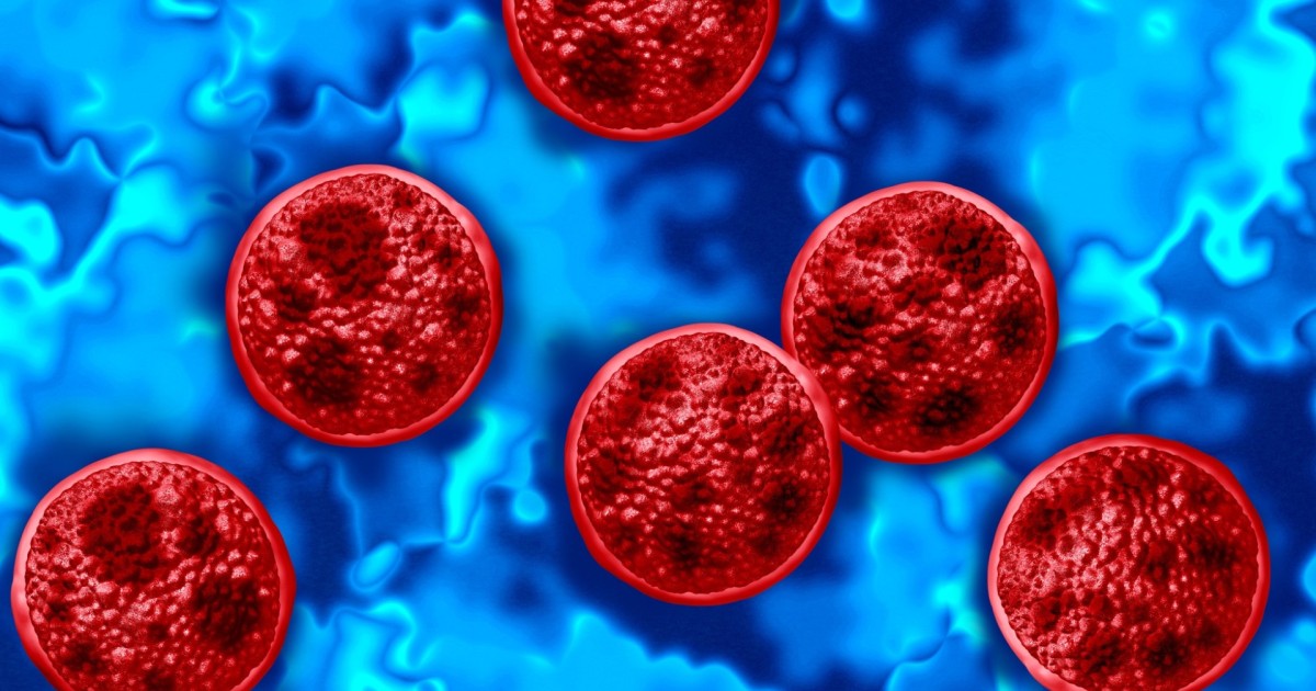 Coverage image for: Michigan reports two deaths linked to cyclosporiasis outbreak