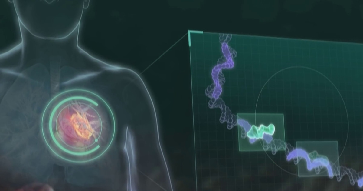 Merck and Moderna say cancer vaccine shows signs of preventing recurrence of melanoma