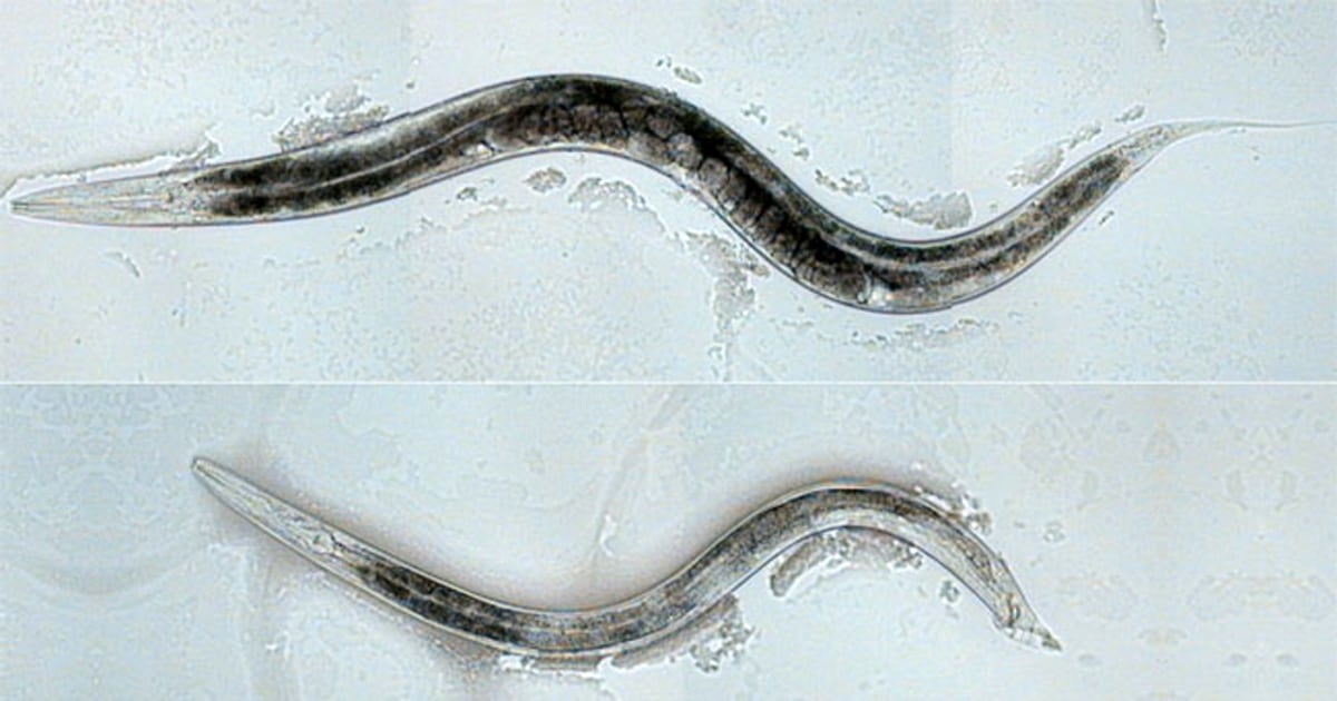 Sexual Orientation Hard Wired In Worms Brains