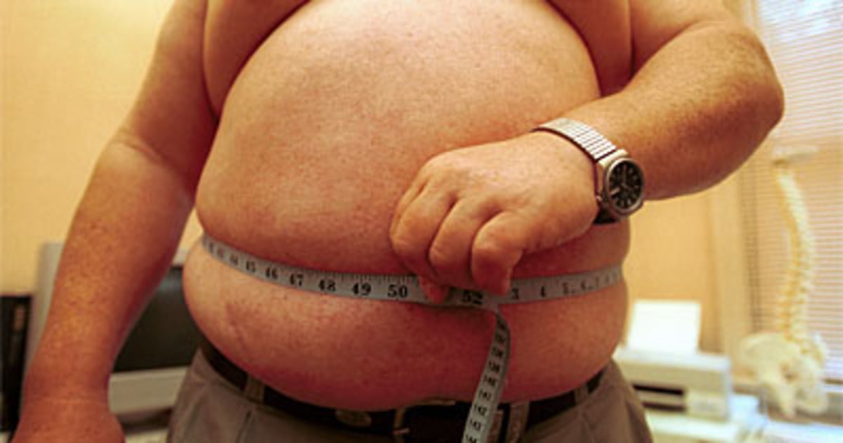Страдающие лишним весом. Люди страдающие ожирением. Люди которые страдают ожирением. Сердце Толстого человека.