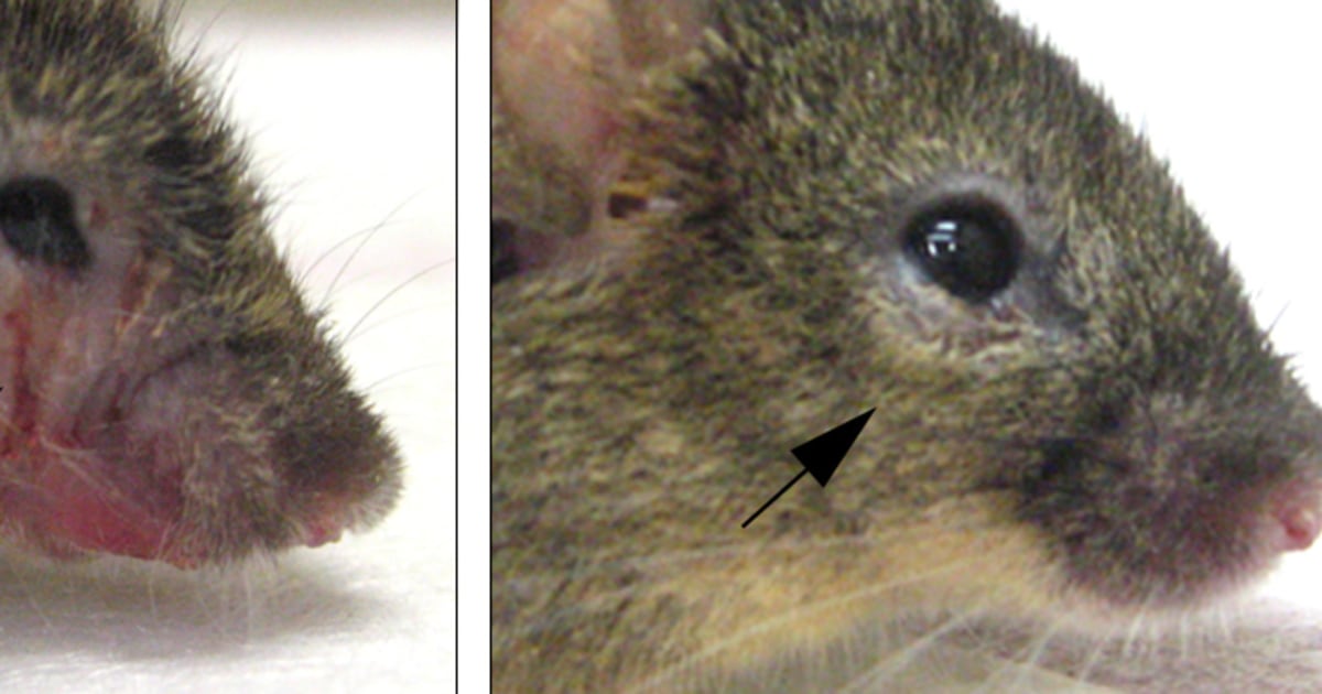Gene mutation linked with obsessive behavior