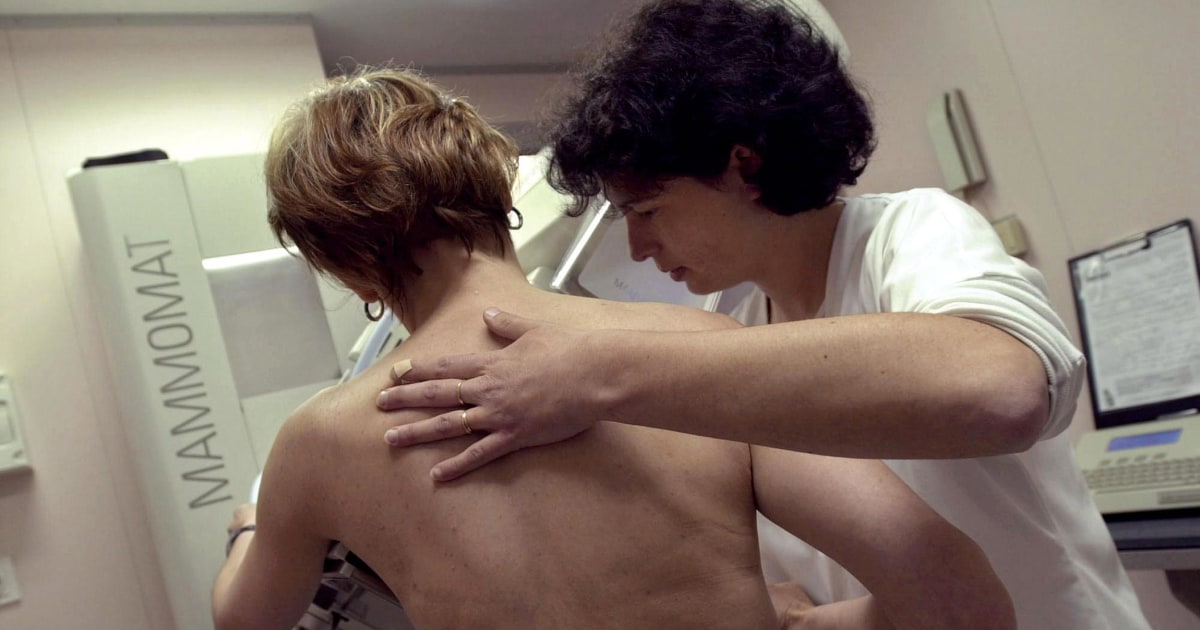 Mammograms Aren't Perfect, American Cancer Society Top Doc Says