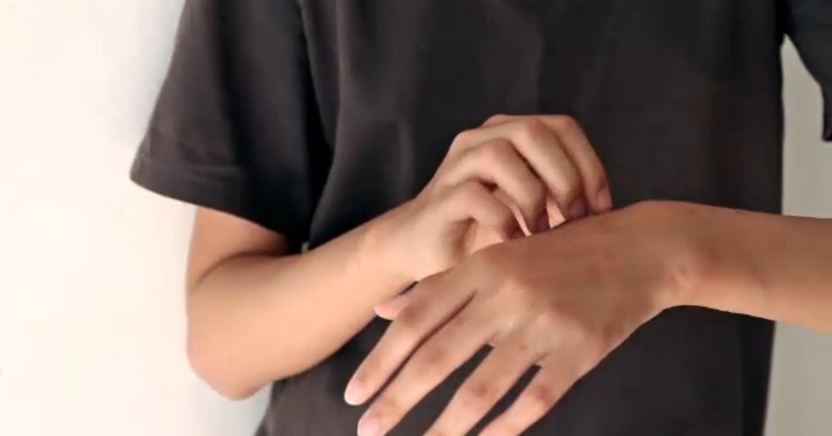 Why Scratching an Itch Really Does Make You Itch More