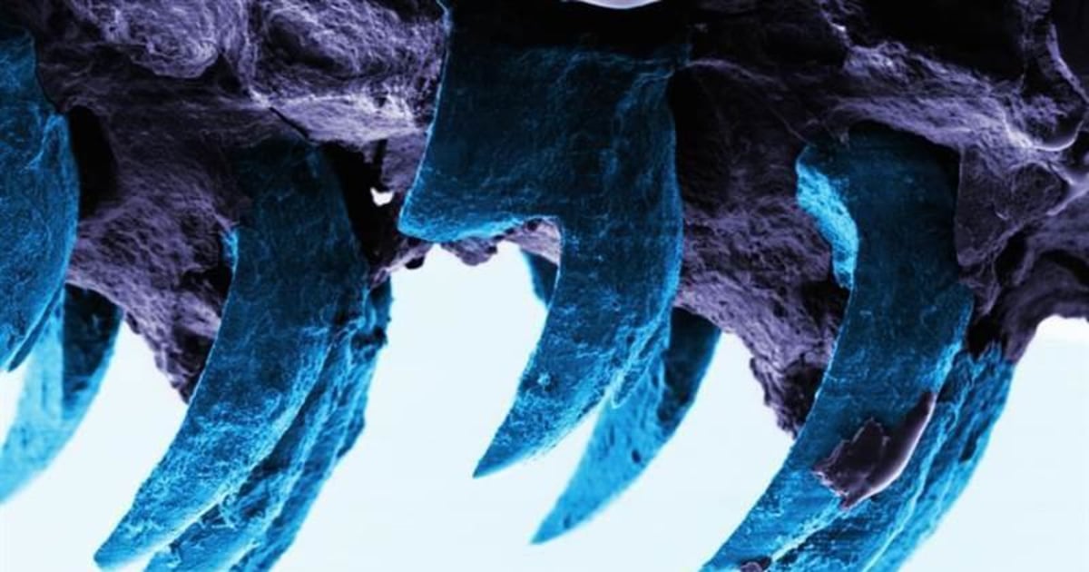 Sea Snail Teeth Top Spider Silk as Strongest Material on Earth