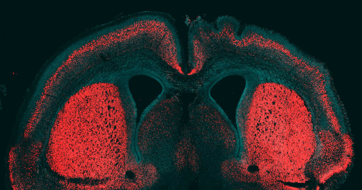 'Big Brain' Gene Found in Humans, But Not in Chimps