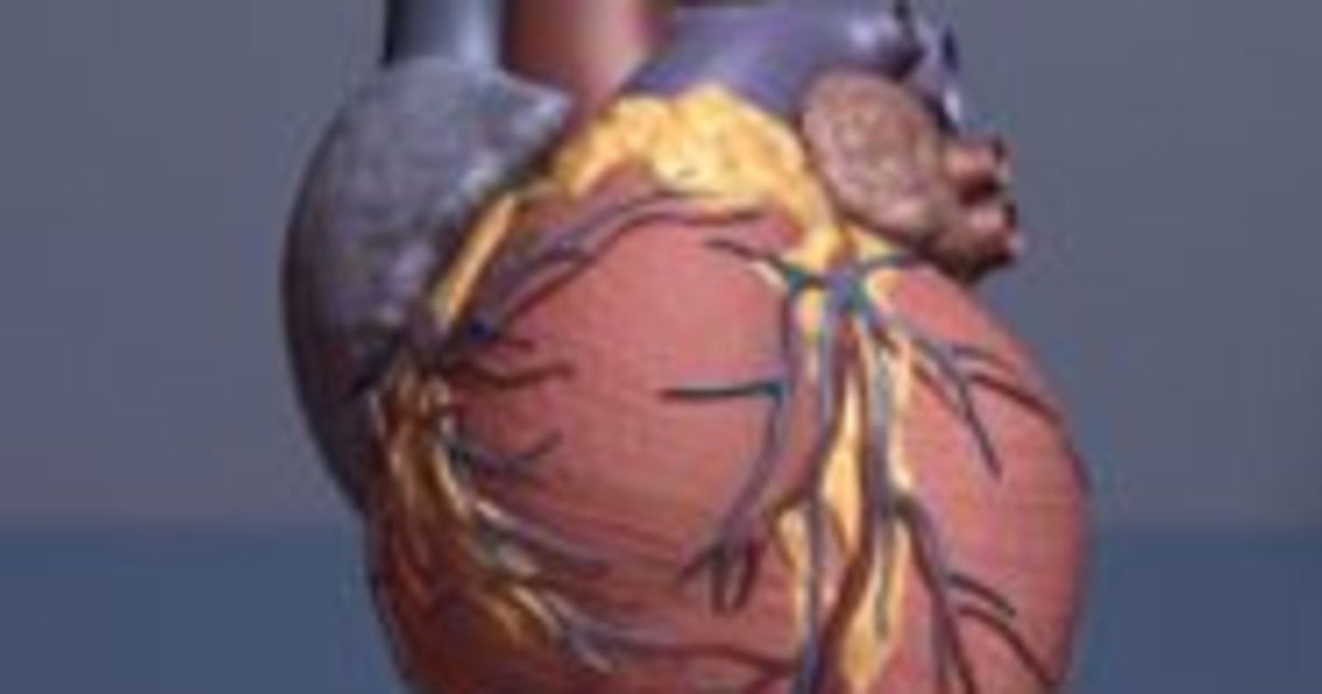 Blacks More Likely To Die Suddenly From Cardiac Arrest, Study Finds