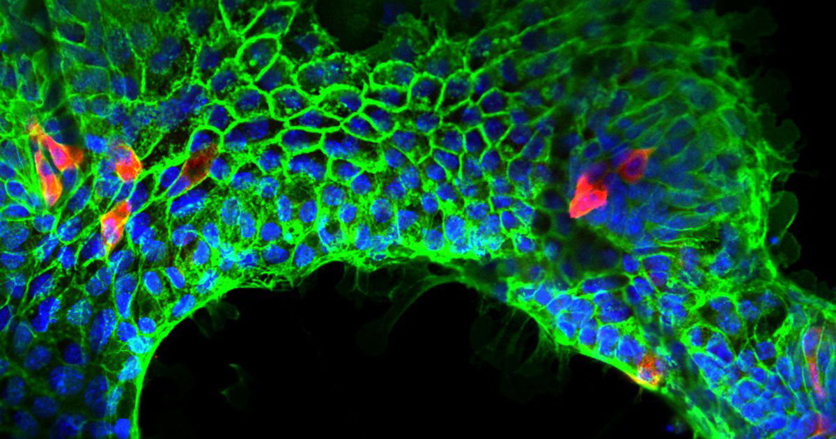 Researchers Grow Kidney, Intestine From Stem Cells