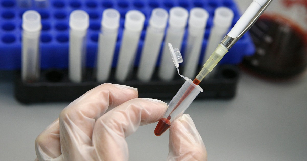 Activists React to New HIV Study, Debunking of 'Patient Zero' Myth