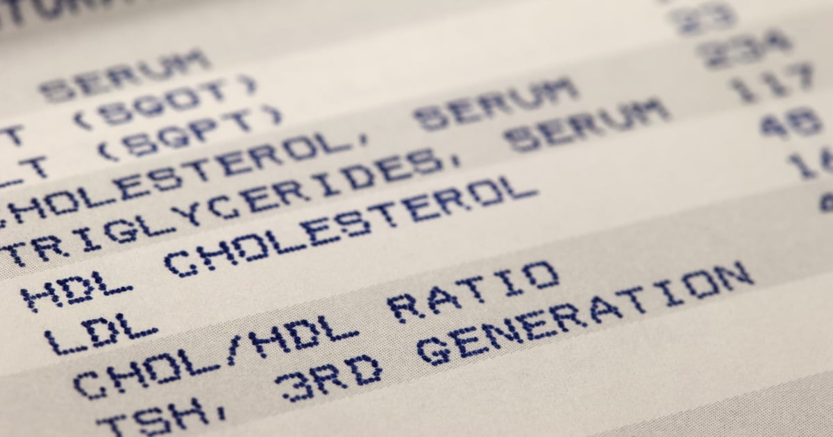 New cholesterol-lowering drug could be an alternative to statins