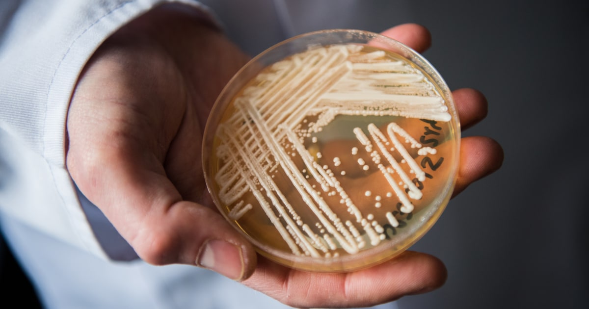 154 cases of fastmoving and multidrugresistant deadly fungus in Illinois