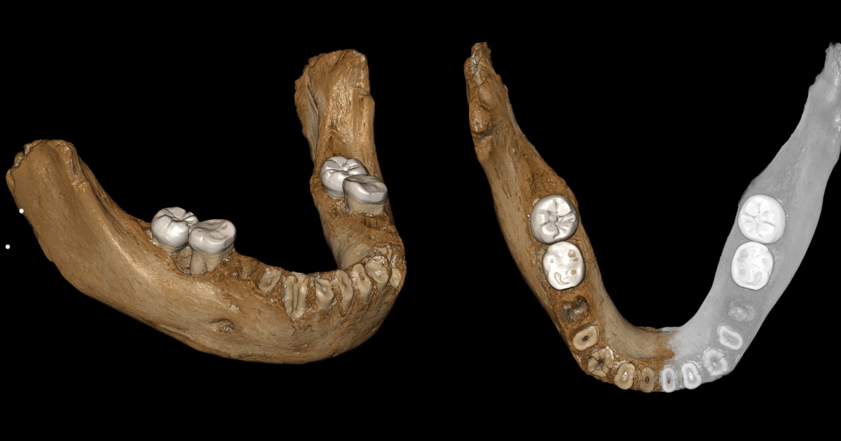 Jawbone fossil from Tibetan plateau sheds light on mysterious