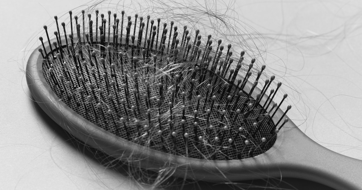 Half of older women experience thinning hair, study finds