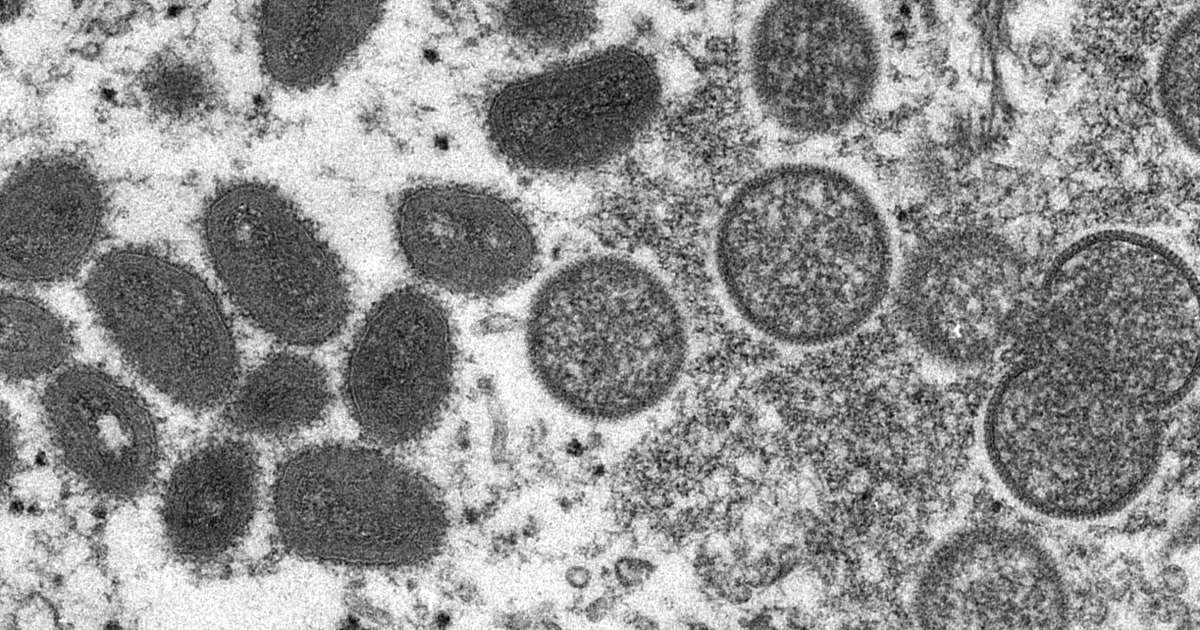 在美国发现了两种截然不同的猴痘，增加了爆发的神秘感