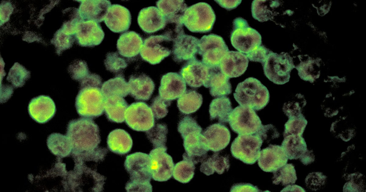 New Commercially Available PCR Test Detects 3 Brain-Eating Amoebas in 3  Hours