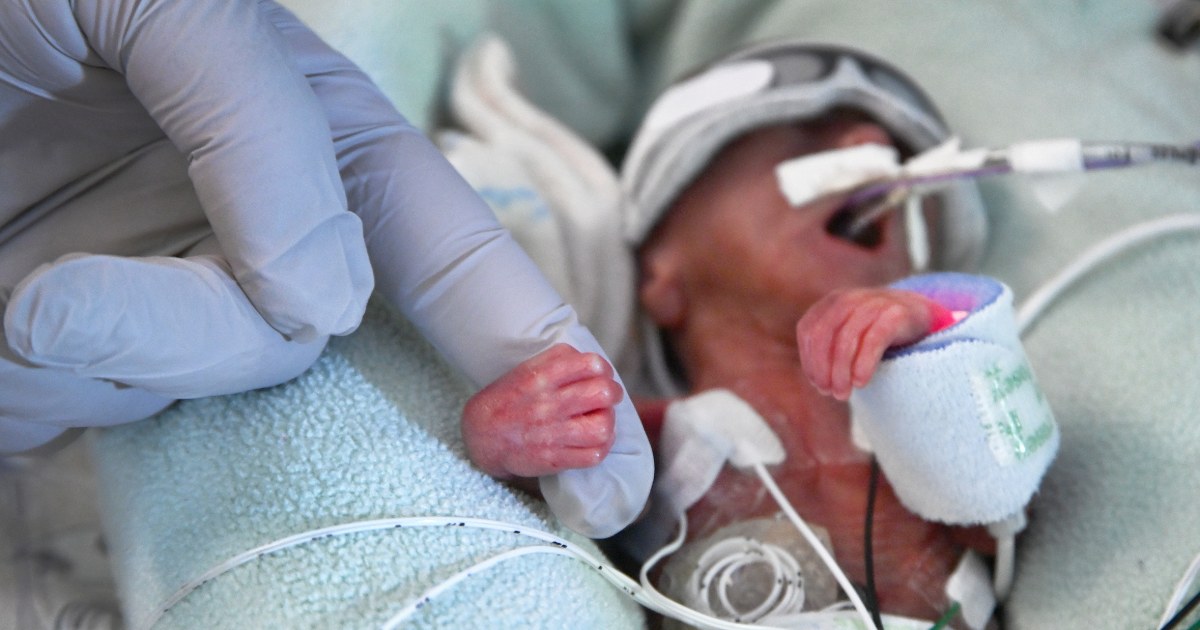 Premature Births At An All Time High In The U S March Of Dimes Report Finds