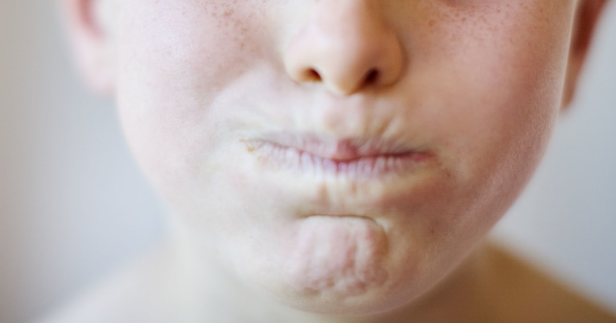 El 'blackout challenge' resurge reto viral que podría ser mortal