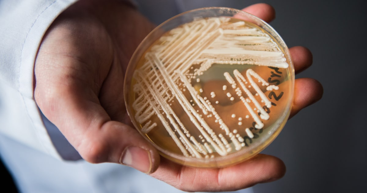 Lethal fungal an infection spreading at an alarming charge, CDC says