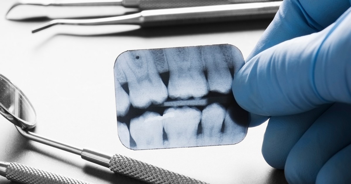 Ожидается, что миллионы людей лишатся стоматологического покрытия после пересмотра Medicaid