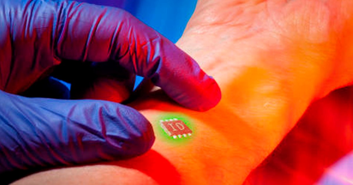 Implantan primer chip que impide beber alcohol al liberar medicamento