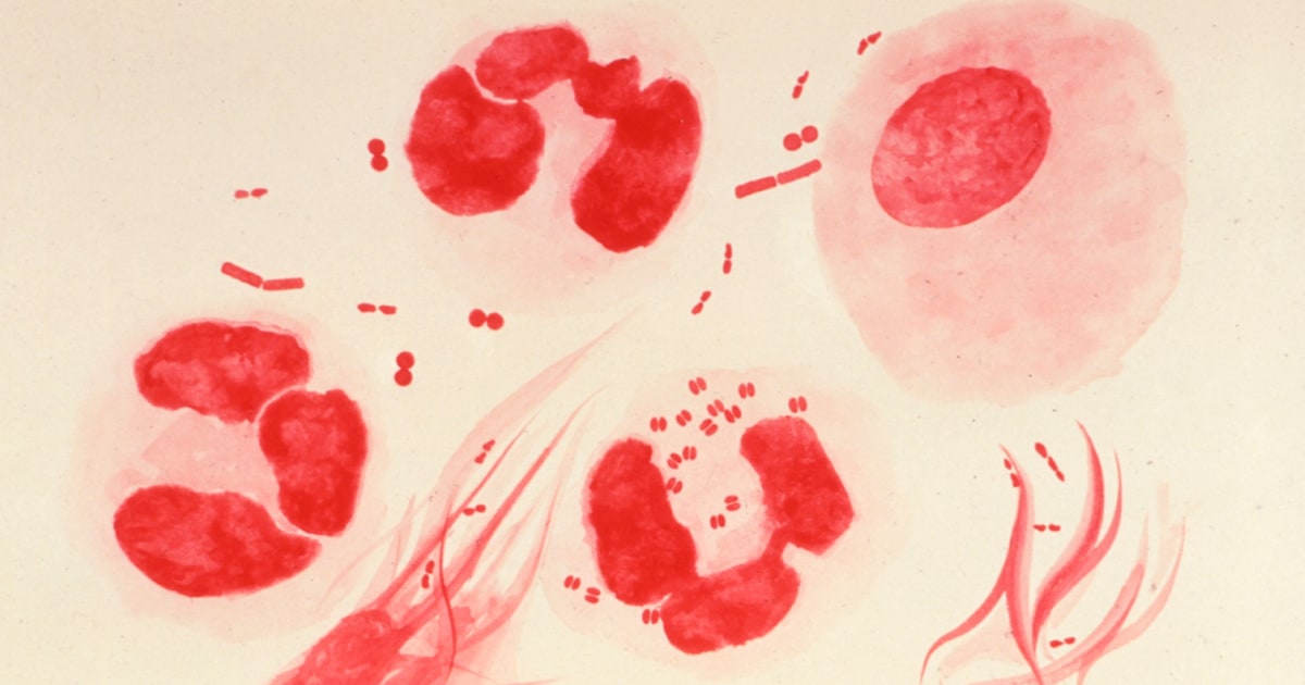 Първият одобрен от FDA домашен тест за гонорея, хламидия ще облекчи ли епидемията?