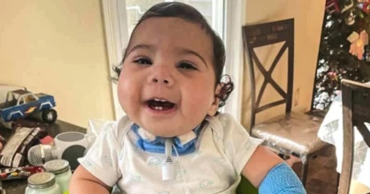 Cabeza pequeña y paladar hendido: detectan un posible nuevo síndrome en ...