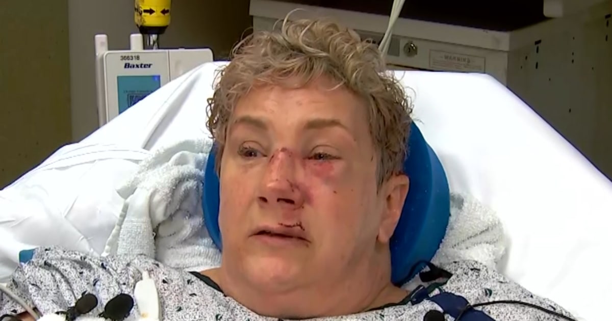Жена от Пенсилвания която беше нападната от мечка докато пускаше