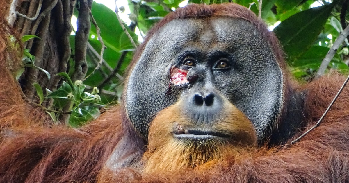 Researchers heard a fight between male orangutans in the treetops of a rainforest in Sumatra, Indonesia; a day later, they spotted Rakus sporting a pi