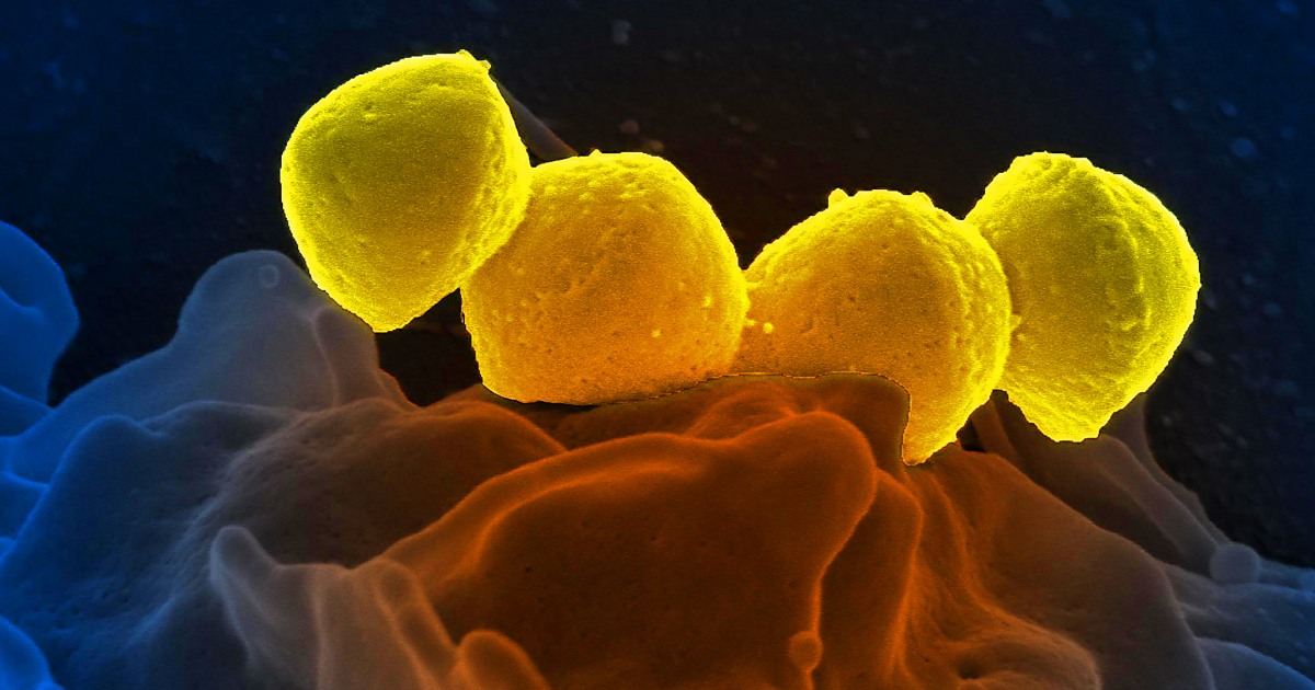 Des infections mortelles au Japon renouvellent les questions sur la bactérie streptocoque du groupe A