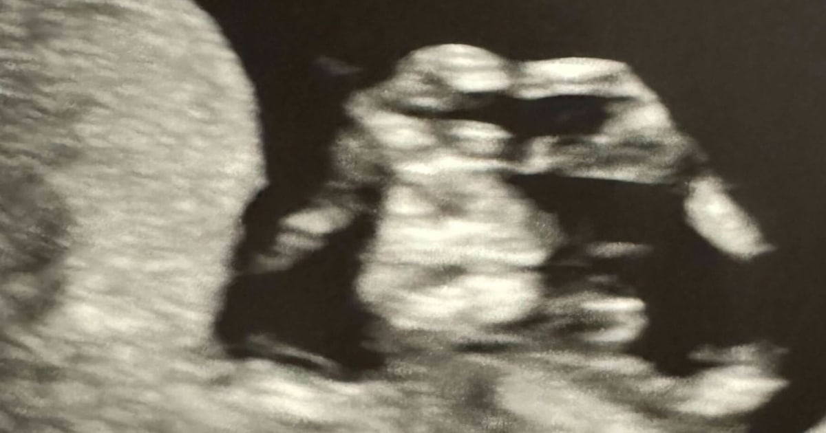 Pregnant Swiftie shares sonogram of her unborn baby imitating Taylor Swift - Vimarsana News