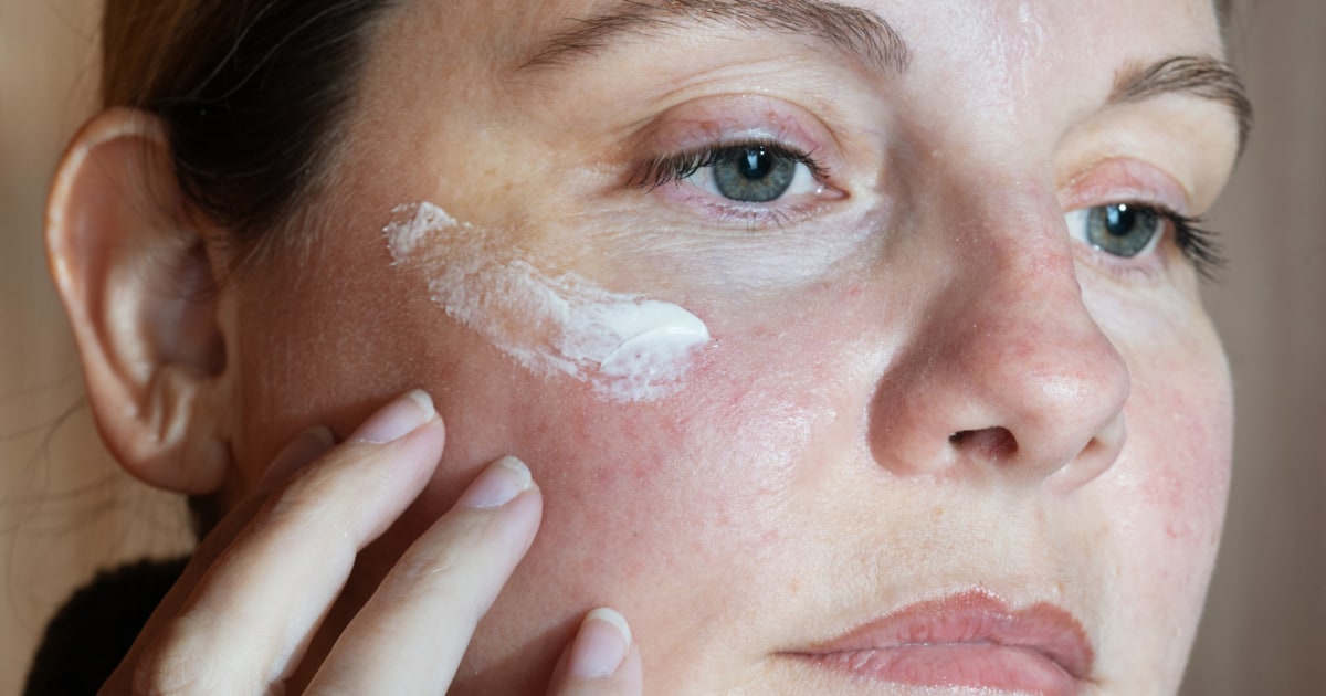 Have acne, rosacea or dark spots? This skin care ingredient can tame all three